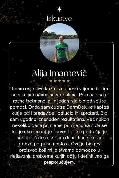 Iskustvo1