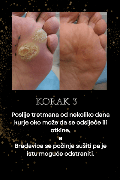 kako-se-koriste-dermdeluxe-kapi--(1)_optimized